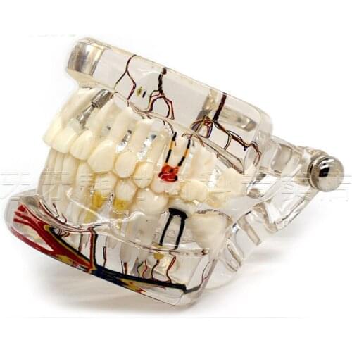 Dental model with nerve adult pathology teeth model doctor - patient communication use dental implant
