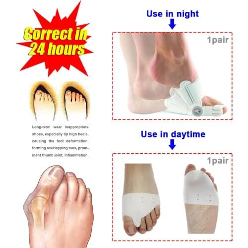 1set=1pair night use + 1pair daytime use) Toes Care Foot Thumb The Big Toe Separator Hallux Valgus Toes Support Toe Corrector