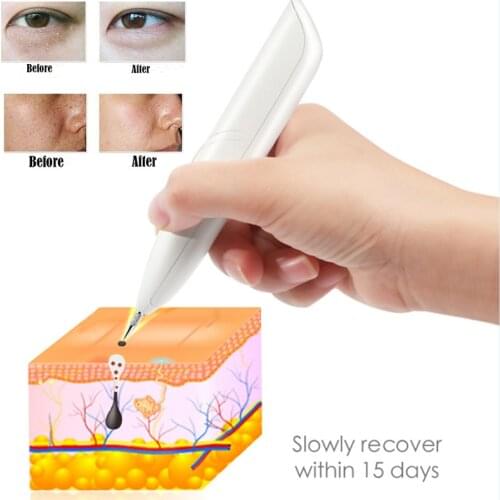 Laser Plasma Pen Remove Freckles Rechargeable Spot Eraser Face Wart Spot Mole Tattoo Dot Remover Facial Skin Cleaner Beauty Care