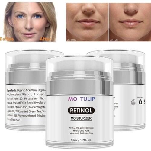 MO TULIP Organic Retinol Moisturizing Face Cream Vitamin C Whitening Anti Aging Wrinkles High Quality Face Cream DROP SHIPPING
