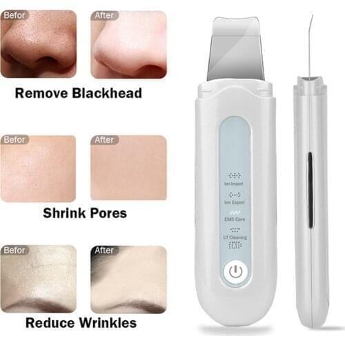 Ultrasonic Facial Skin Scrubber Cleaner Peeling Shovel Ion Acne Blackhead Remover Peeling Shovel Cleaner Facial Massager Skin