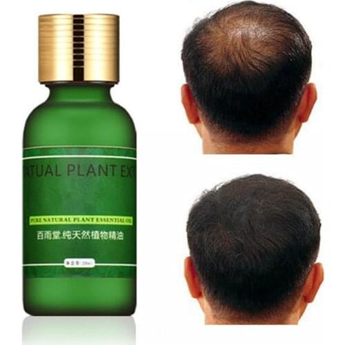 Essential Oils Hair CareEssence Original Authentic 100% Hair Loss Liquid Health Care Beauty Dense Hair Growth Serum