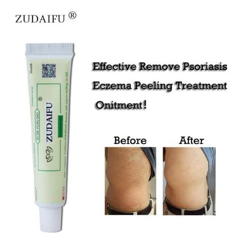 3pcs ZUDAIFU Body Psoriasis Cream Skin Care Psoriasis Ointment Dermatitis Eczematoid Eczema Ointment Skin Treatment Cream no box