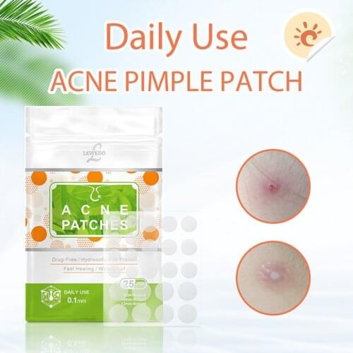 25 Stickers Acne Pimple Patches Acne Treatments Pimple Remover Tool Blemish Spot Facial Mask Beauty Face Skin Care Tools