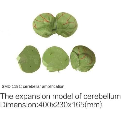 SMD1191 cerebellar magnification