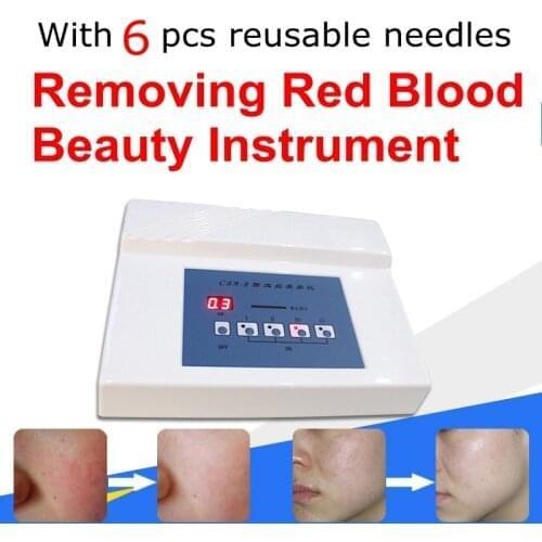 Red Blood Vessel Spots Vascular Removal Beauty Equipment Needle RF Spider Veins Removal spider veins Anti Redness Machine