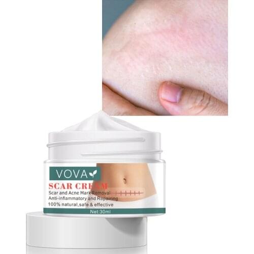 30ml Scar Cream Skin Care Products Scar Removal Cream