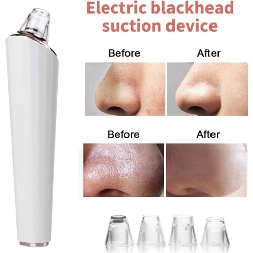 Electric Blackhead Vacuum Remover USB Rechargeable Nose Face Acne Cleaner Skin Pore Care Facial Cleansing Tool with Suction Head