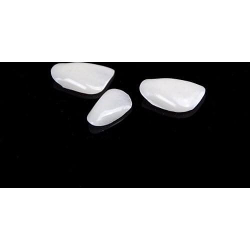 MceHKF Veneers