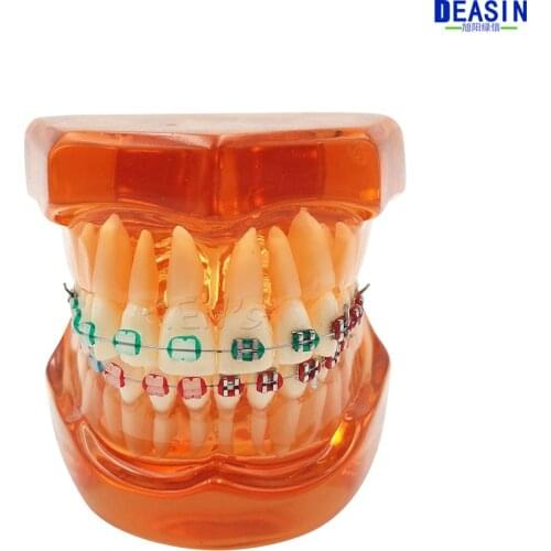 High Quality Teeth model With metal & ceramic brackets Irregular tooth Ortho Metal dentist patient student learning model