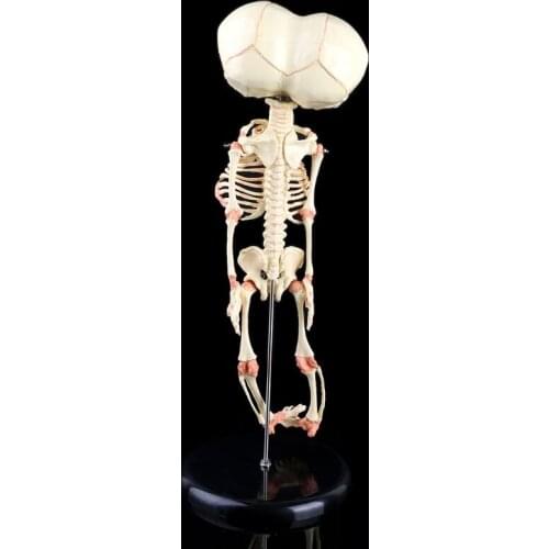 Human Baby Deformed Head Skull Research Model Skeleton Anatomical Brain Anatomy K3KE