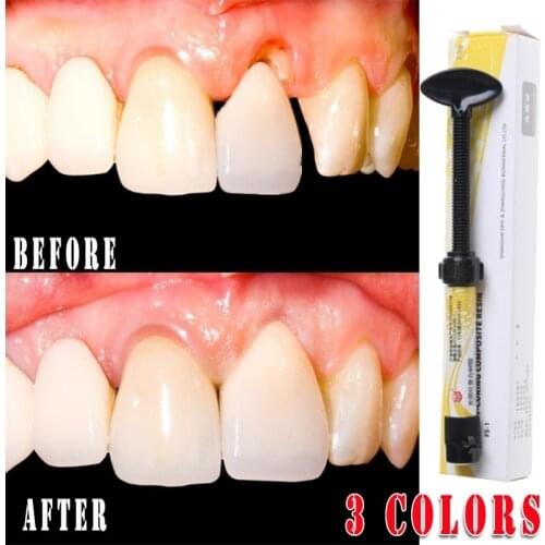 A1 2 3 Oral Care Light Cured Teeth Tool High Strength Accessories Tree Resin Dental Shade Low Shrinkage Micro Hybrid Composite