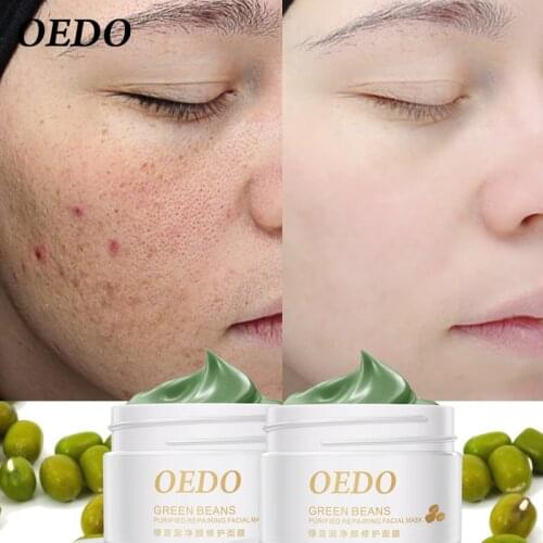 2PCS Acne Blackhead Treatment Mask Mung Bean Mud Peeling Remover Facial Cream Effective Whitening Hydrating Skin Care Cleaning