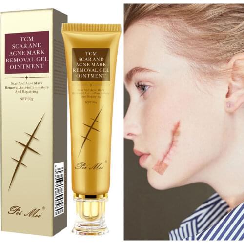 Acne Scar Removal Cream Repair Stretch Marks Gel Remove Burn Scars Surgical Scar Repair Treatment Smoothing Body Skin Care 30g