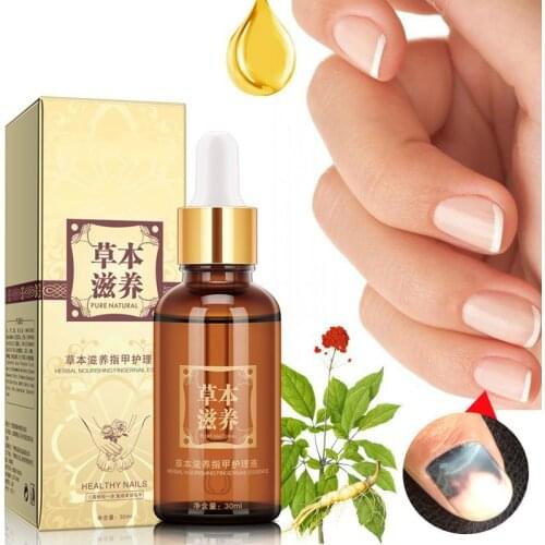 Herbal Fungal Nail Treatment Essential oil Hand and Foot Whitening Toe Nail Fungus Removal Infection Feet Care Polish Nail Gel