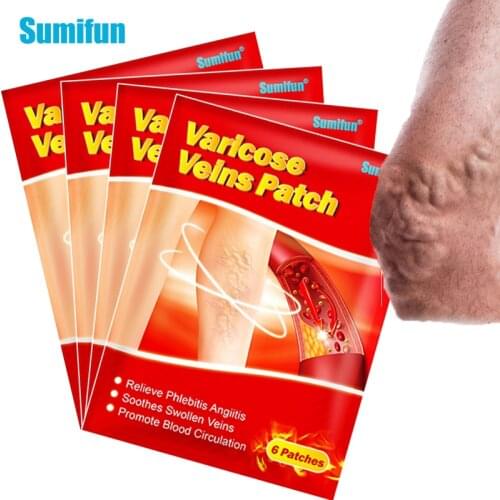 24pcs Sumifun Varicose Veins Plaster Vasculitis Phlebitis Spider Cream Varicosity Angiitis Removal Herbal Medical Plaster K06201
