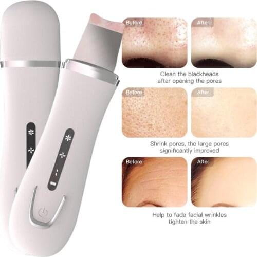 Ultrasonic Skin Scrubber Vibration Face Spatula Blackhead Remover Facial Scrubber Shovel Clean Cavitation Peeling Facial Lifting