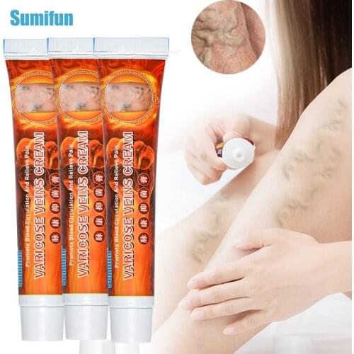 3/5pcs Treatment For Varicose Veins 100% Chinese Herbal medicine For Varicosity Angiitis Removal Phlebitis legs Veins Ointment