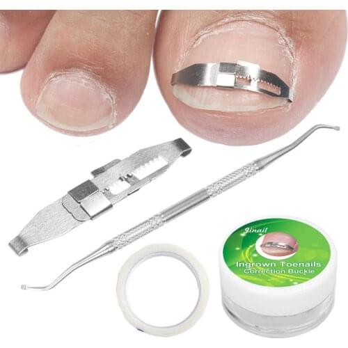 1 Set Ingrown Toe Nail Straightening Clip Wire Fixer Curved Tool Elastic Patch Correction Pedicure Patches Toenail Toenail M9V0