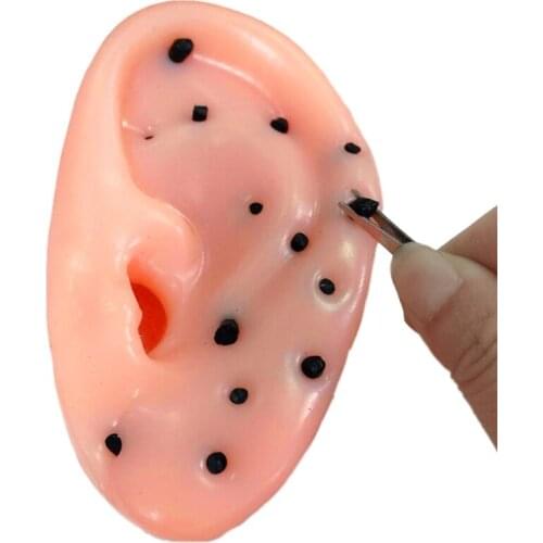 Pimple Popper Toys Ears Shaped Pimple Popping Decompression Acne Blackheads Remover Fun Toy
