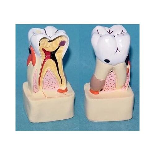 Human Teeth Anatomical Model pathology Oral Care Medical Teaching free shipping