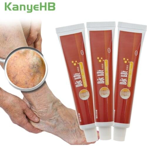 3pcs Varicose Veins Ointment Vasculitis Phlebitis Spider Cream Pain Varicosity Angiitis Removal Leg Pain Medical Plaster A429