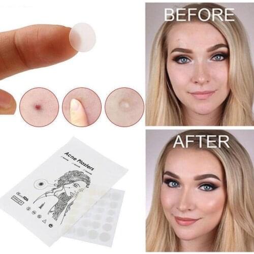 108pcs Acne Patch Hydrocolloid Invisible Pimple Master Patch Skin Tag Removal Patch Pimple /Blackhead Blemish Removers