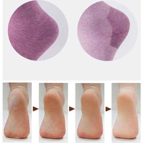 1 Pair of Silicone Moisturizing Gel Heel Socks Cracked Foot Dry Skin Care Protector Feet Care Tool Treatment Spa Sock