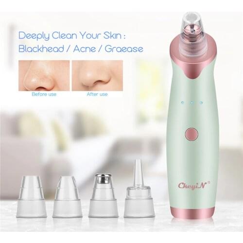 Electric Comedo Suction Microdermabrasion Diamond Machine Vacuum Suction Blackhead Remover Face Whitening Cleaning Extractor 35