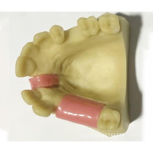Imitating bone in the model of missing maxillary teeth Practical operation Dental implant placement training