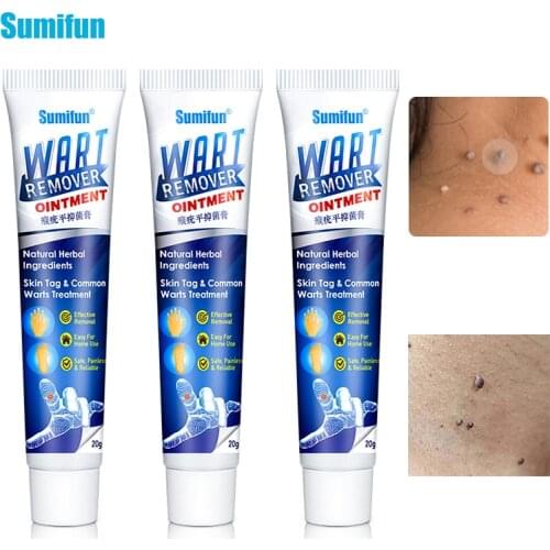 New Sumifun Warts Remover Ointment Wart Treatment Cream Skin Tag Remover Herbal Extract Corn Plaster Warts Ointment