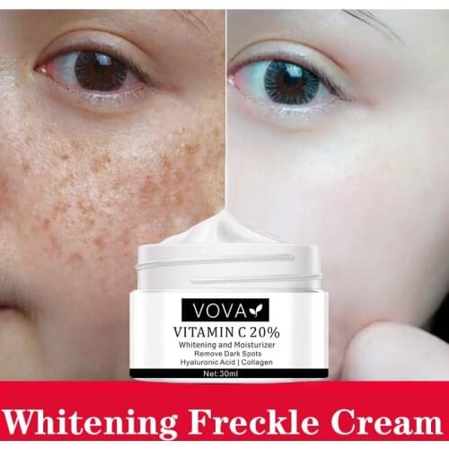 Vitamin C 20% Whitening and Moisturizer Remove Dark Spots Hyaluronic Acid Collagen Anti Aging Wrinkle Freckle Remove Cream