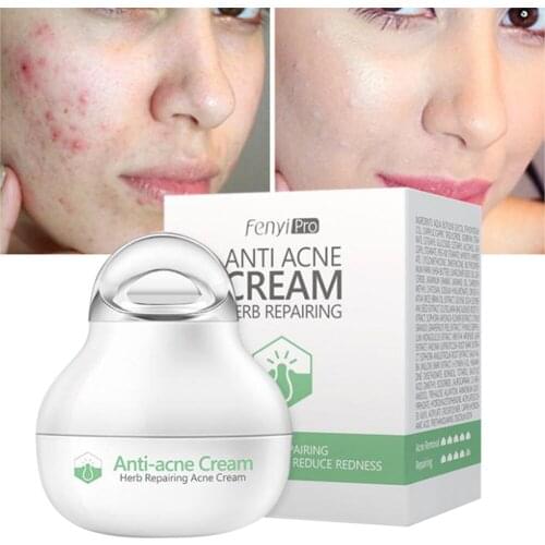 Effective anti-acne cream acne treatment fade acne spots oil control shrink pores whitening moisturizing acne cream skin care
