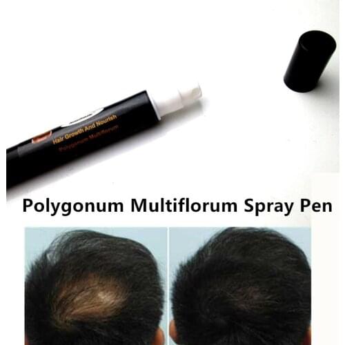 Better Than Andrea Polygonum Multiflorum Hair Growth Tonic for Hair Color Oil Serum Spray Products Tratamiento Para El Cabello