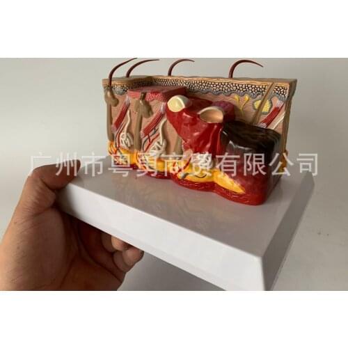 Human Skin Magnification Pathology Inflamed Abscess Lesion Hair Model