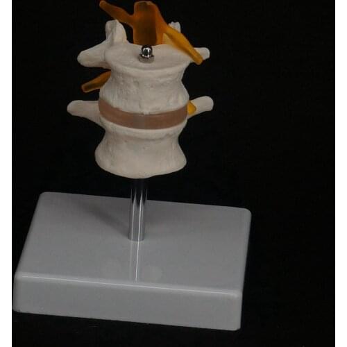 Life Size Two Section Lumbar Spine Skeleton Model with Stand Medical Teaching