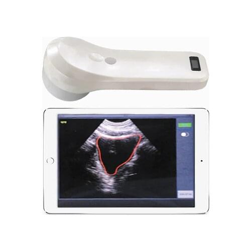 2019 BProbe-2 4D Wireless Bladder Scanner