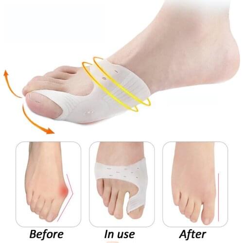 2Pcs Silicone Hallux Valgus Toe Separator Silicone Insoles Toe Overlapping Pain Relieve Spreader Foot Protector Inserts Orthosis