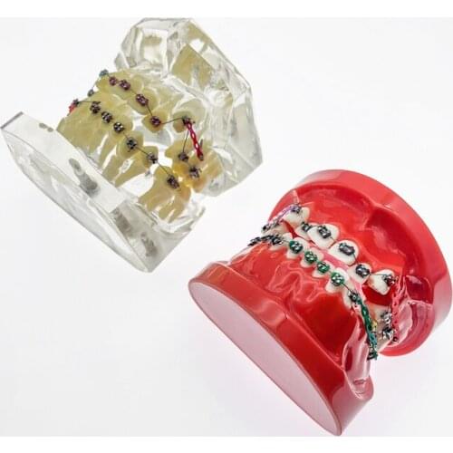 Dental Orthodontic Model Teaching Dental Models Are Used For Teaching Teaching demonstrating tooth model