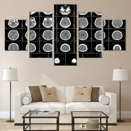 5 Pieces Technology X-Ray Canvas Painting Computer Tomography Posters Pictures Body Part Wallpapers For Home Room Clinic Decor