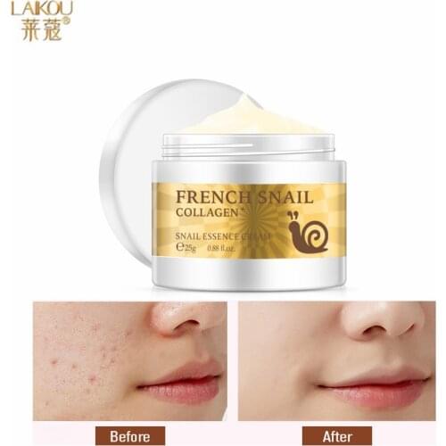 LAIKOU 25g Snail Collagen Essence Nourish Cream Whitening Moisture Shrink Pores Anti-Wrinkle Anti Aging Professional Skin Care