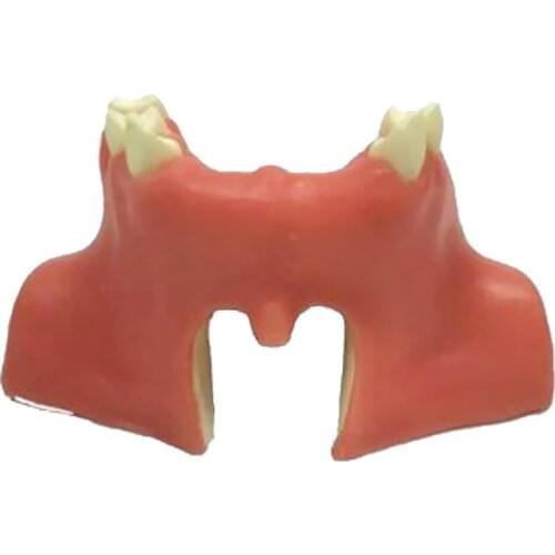 Upper Jaw Sinus Lift Implants Restoration Tooth Practice Model