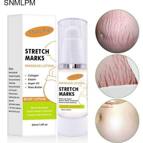 MOPOYAT Remove Pregnancy Scars Acne Cream Stretch Marks Treatment Maternity Repair Anti-Aging Anti-Winkles Firming Body Creams