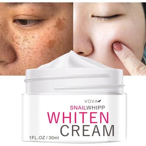 Vova Face Cream Anti-freckle Whitening Cream to Remove Melanin Face Dark Spots Corrector Cream for Age Spot Skin Whitening Cream