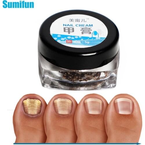 1pcs Onychomycosis Paronychia Herbal Repair Cream Fingers Feet Nail Fungus Treatment Ointment Anti Fungal Nail Infection P0086