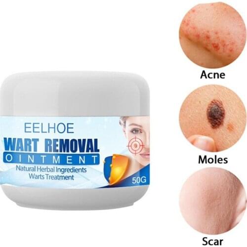 Wart Remover Safe Painless Skin Tags Removal Ointment Fast Acting Remover Cream for Warts Moles Corn for All Skins