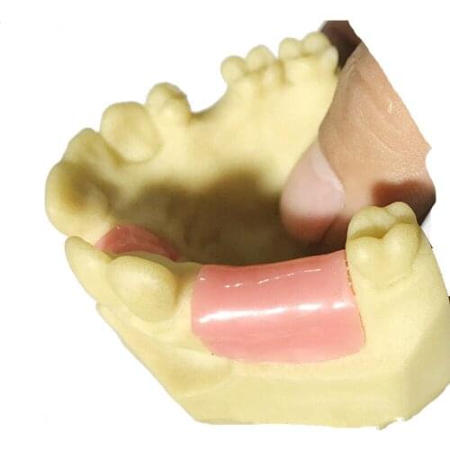 Maxillary Missing Tooth Model Bone Imitating Oral Teaching Aids Dental Implant Placement Exercise Prop Medical Equipment