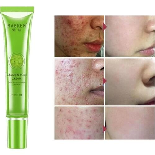 SERSANLOVE Facial Care Products