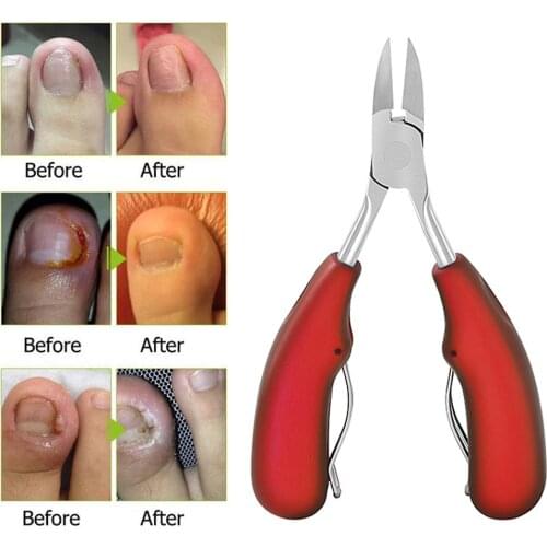 New 1PC 4Color Stainless Steel Eagle Mouth Toe Nail Clippers Finger Cuticle Nail Correction Dead Skin Dirt Remover Pedicure Tool