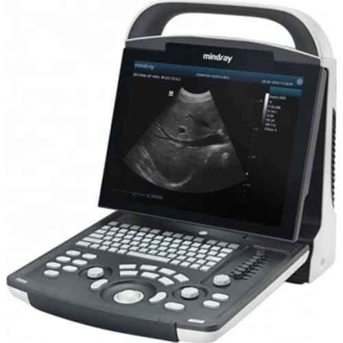 Mindray DP-20 Portable Ultrasound Price Ultrasound Machine For Sale